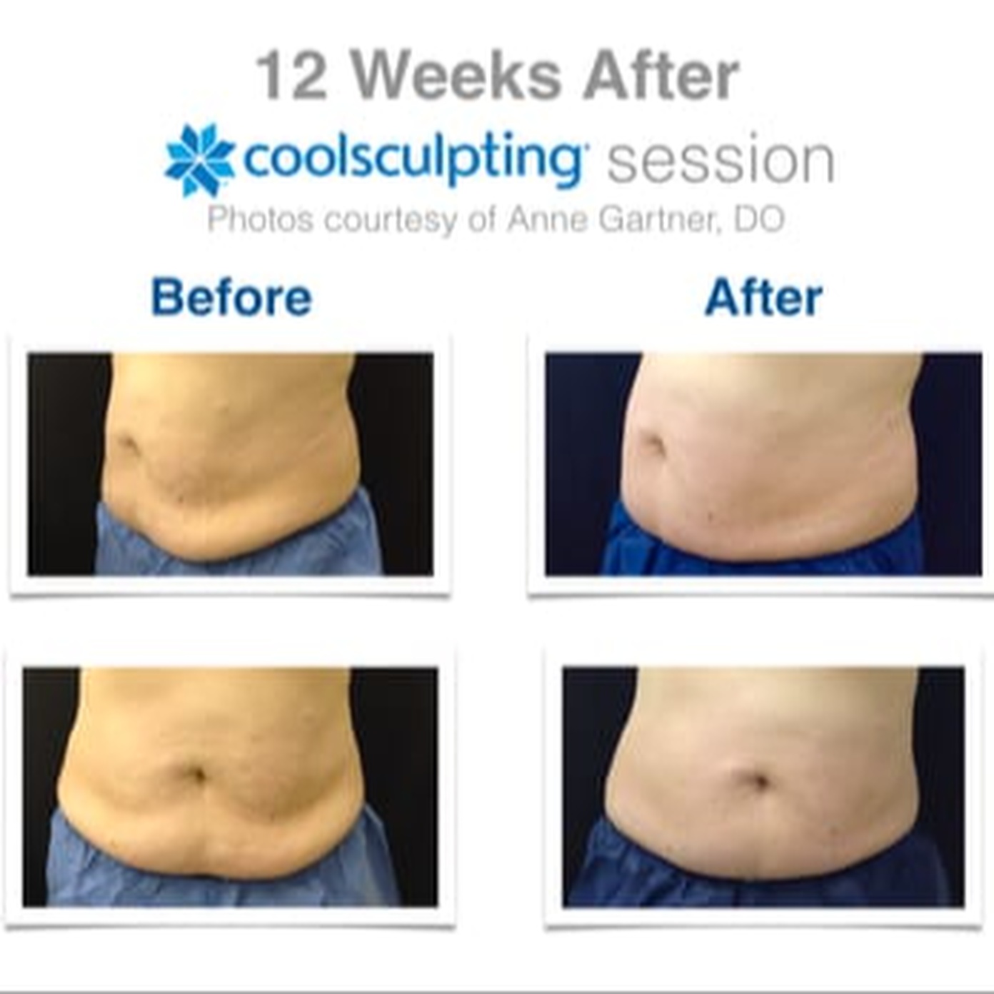 Dr. Anne Gartner, DO