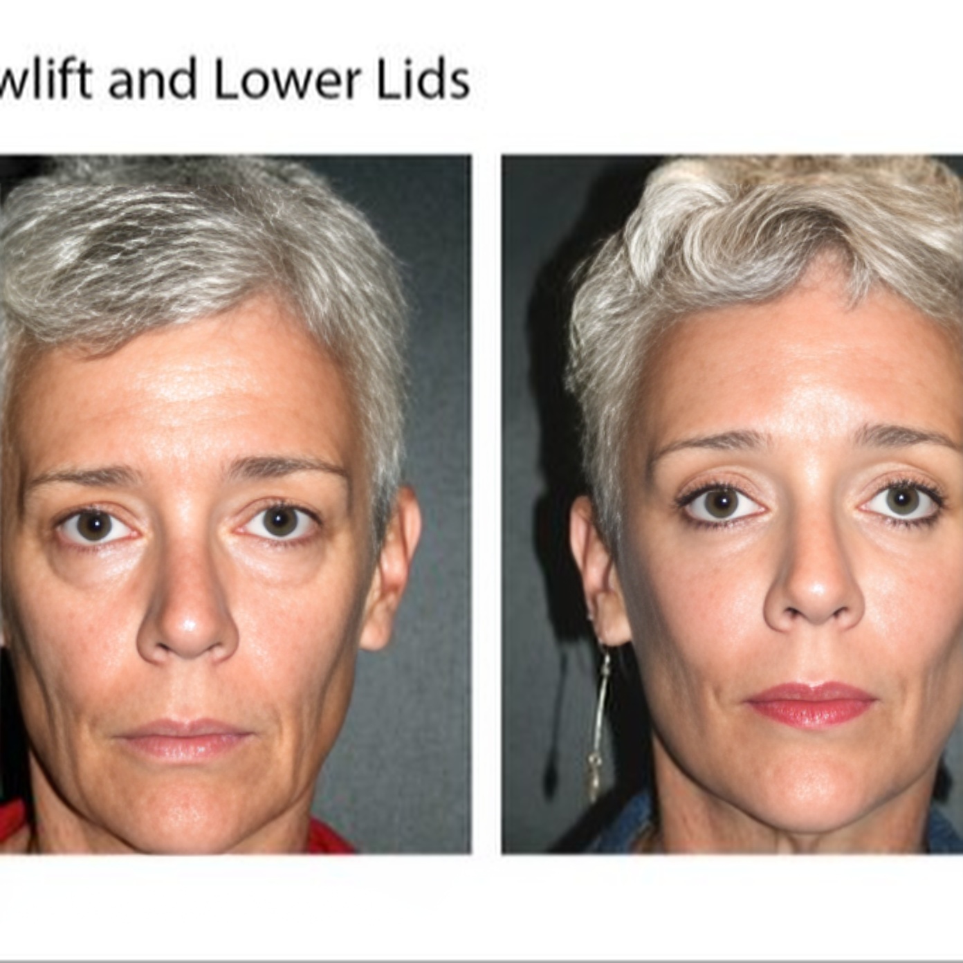 Dr. Ludwig A. Allegra,