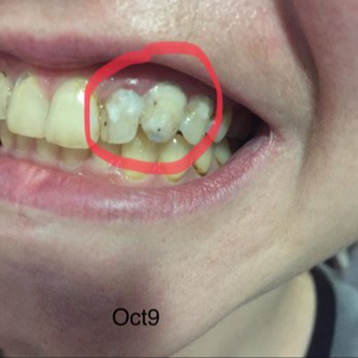 Dr. Meena Yegneswaran, D