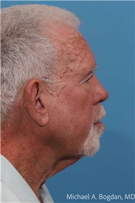 Dr. Michael A. Bogdan,