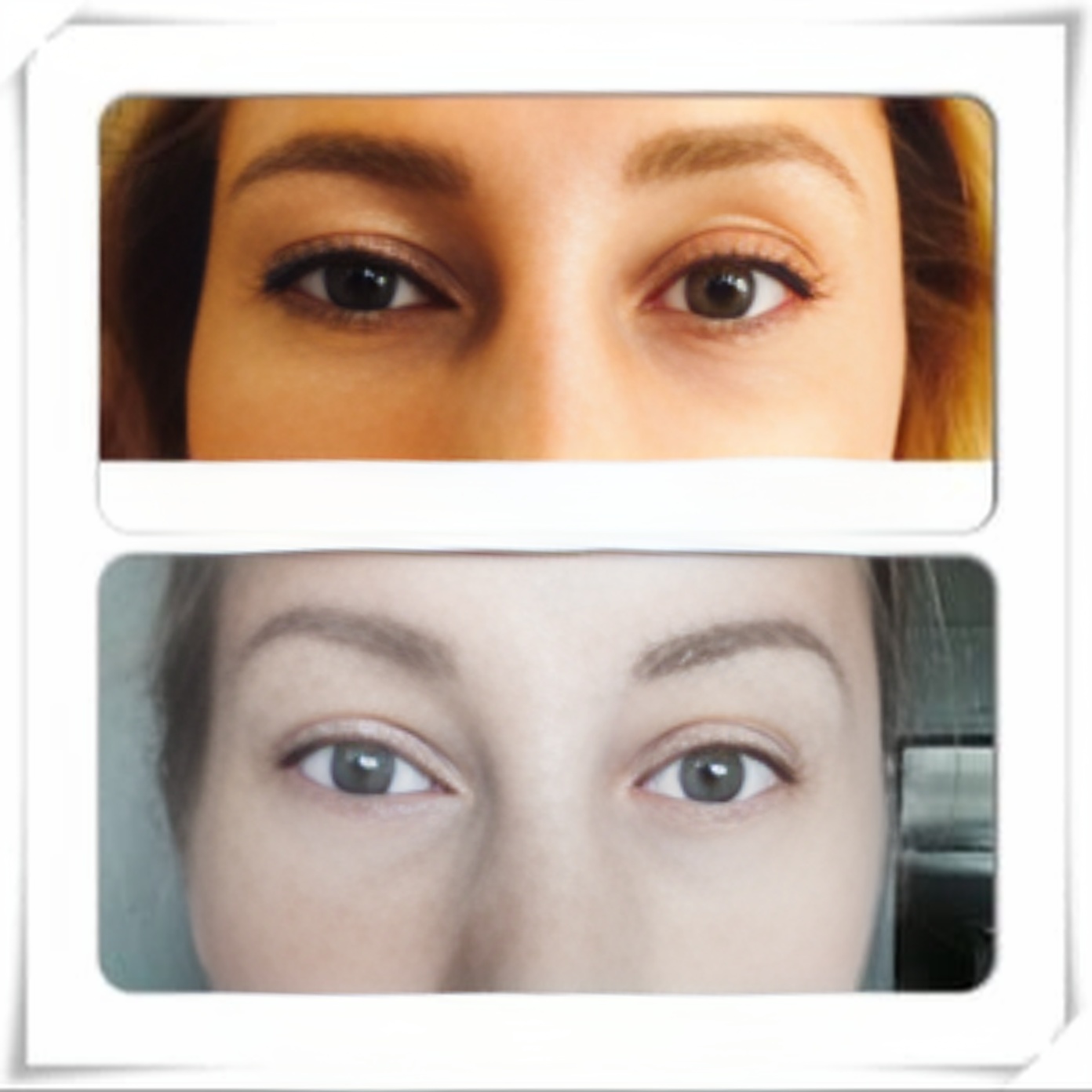 Dr. Peter Levin, MD - Oculoplastic Surgeon, Board Certified in Ophthalmology in Mountain View, California