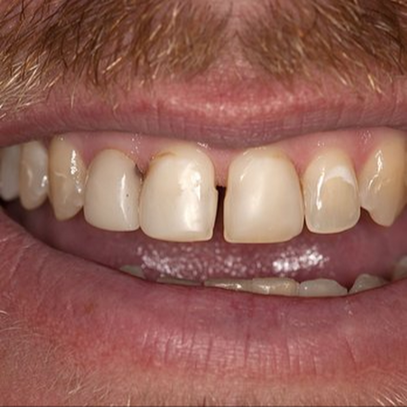 Dr. Vicki Borowski, DDS