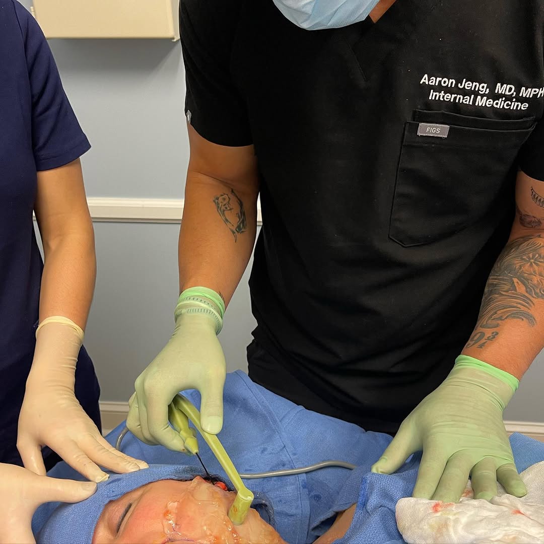 Instagram post by Dr. Aaron Jeng: Up next #facetite #bodytite #liposuction … pre book at our event on April 9th. DM @lilynancyblu