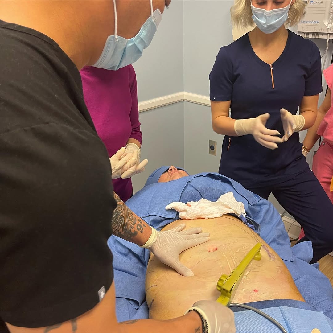 Instagram post by Dr. Aaron Jeng: Before liposuction #bodytite is the best way to get collagen back and prevent sagging of the skin. Perfect combination of treatments gives t…