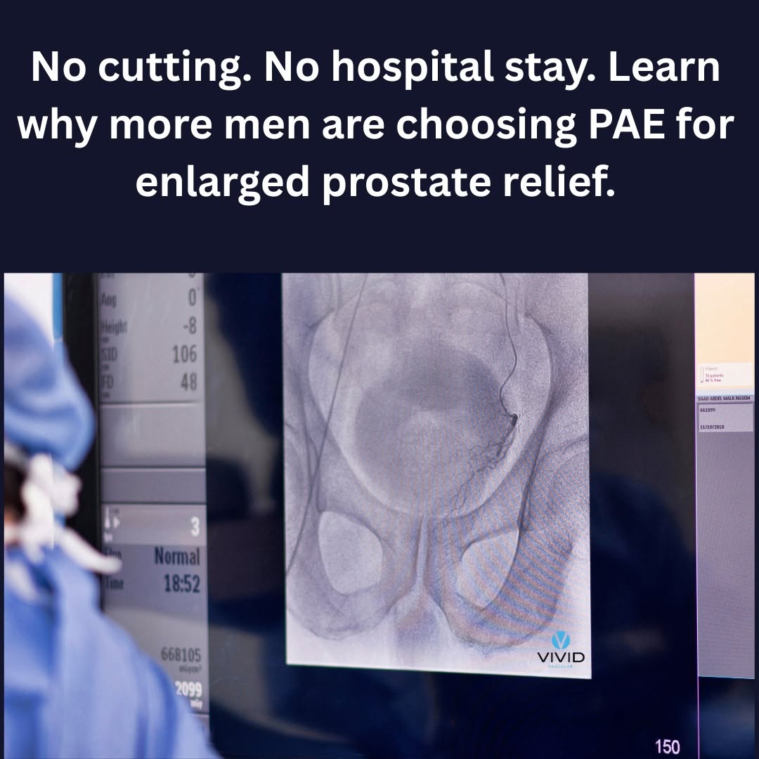 Instagram post by Dr. Adam Gropper: What Is PAE? A Modern Solution for BPH ㅤ Prostate Artery Embolization (PAE) is a minimally invasive treatment for men suffering from Benign …