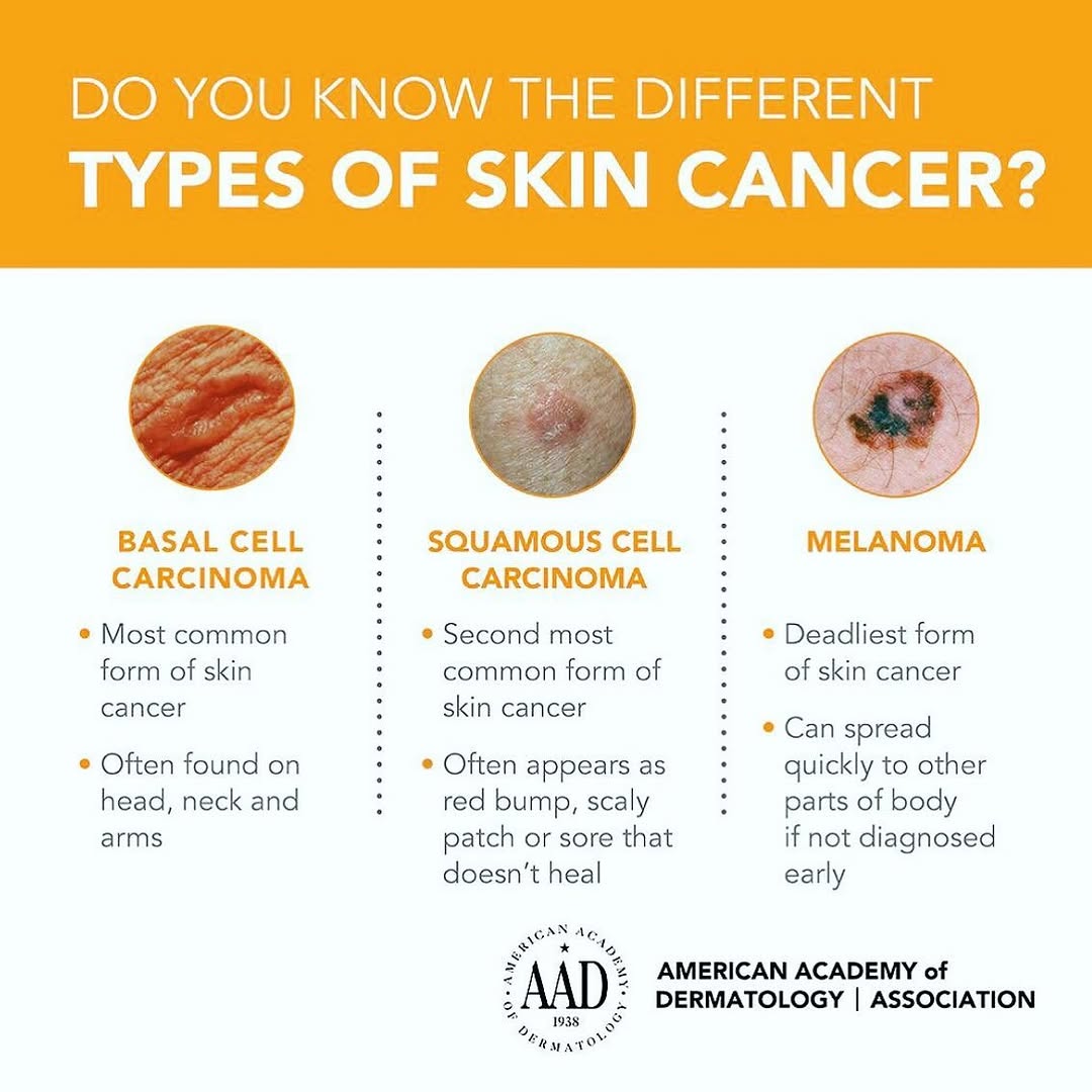 Instagram post by Dr. Adriana K. Holy: May is Skin Cancer Awareness Month. Call us for any concerns. #skincancerawarenessmonth #aad #spfeveryday #spfup