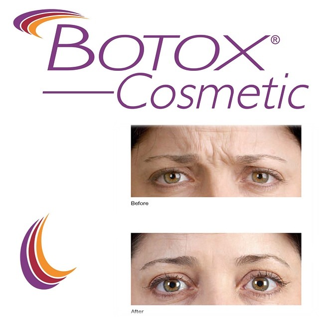 Instagram post by Dr. Adrienne Lam: We're still celebrating the #grandopening of our #moore #okc clinic. Now offering #Botox treatments at a special discounted rate! No more #f…