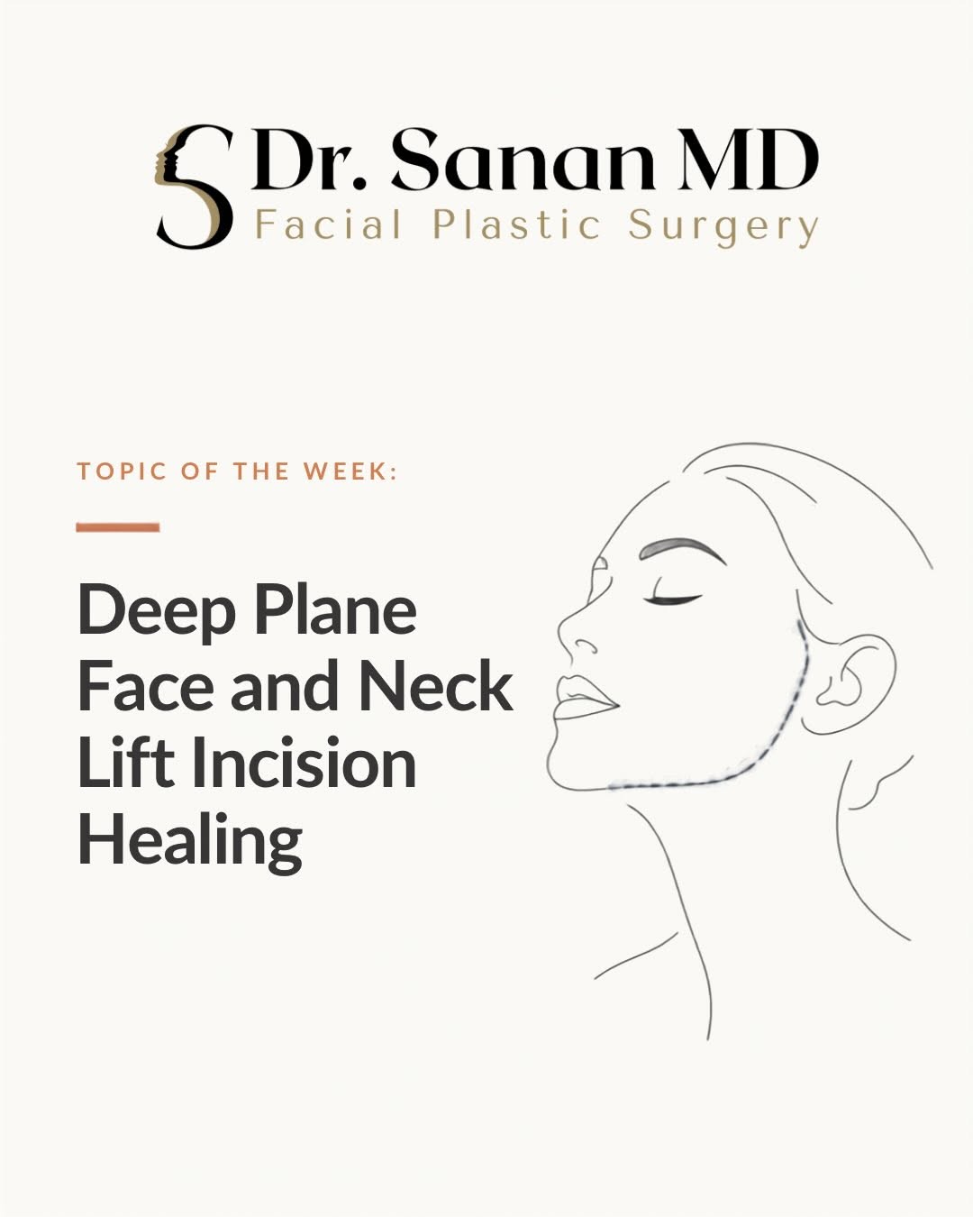 Instagram post by Dr. Akshay Sanan: ✨Deep Plane Face and Neck Lift Incisions✨ “What will my incisions look like?” Understandably, this is one of the most common questions we he…