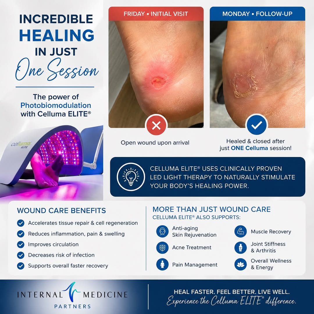 Instagram post by Dr. Alejandro Blanco: ✨ The Power of Medical-Grade Light Therapy ✨ Our patient arrived on Friday with an open wound, received ONE Celluma ELITE® session, and retu…