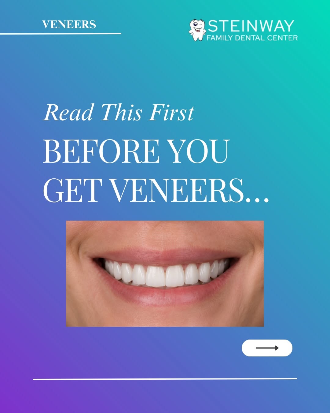 Instagram post by Dr. Aleksandr Dayanayev, DDS: Before you get veneers, remember this: The best veneers don’t look fake. They look natural, balanced, and made for YOUR face. ✨ Choosing ven…