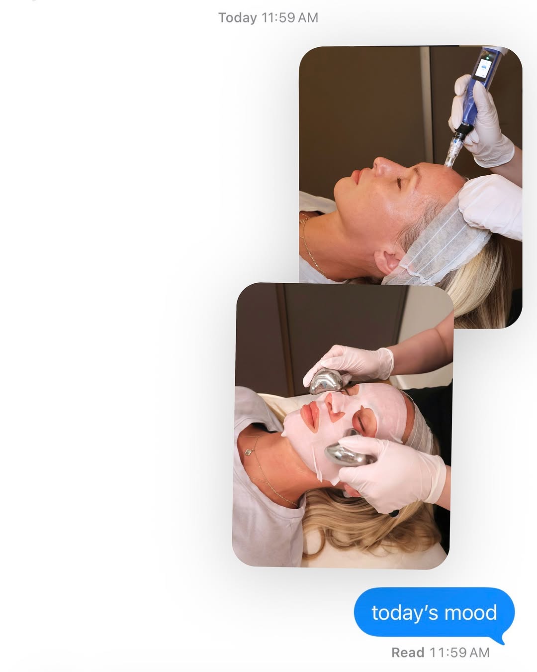 Instagram post by Dr. Ali Vafa: Today’s mood: Microneedling. Stimulating collagen, refining texture, and supporting healthier-looking skin.