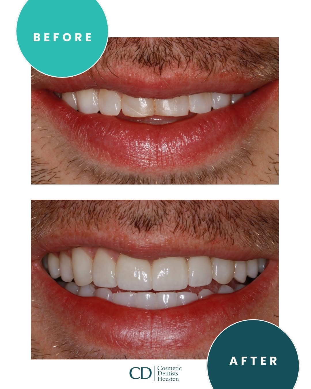 Instagram post by Dr. Amanda Canto, DDS: This is what confidence looks like. 💫 Dr. Parraga gave this patient a brighter, fuller smile that's completely natural, completely them, ju…