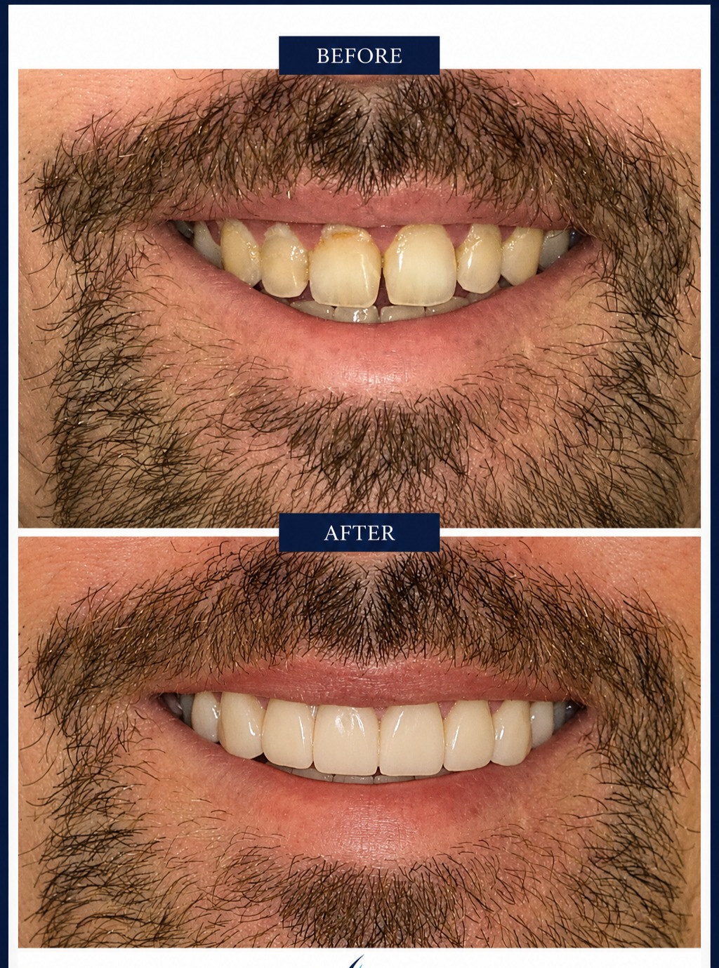 Instagram post by Dr. Amanda McPherson: Dental disease can take so much from a person. Nothing makes me more proud than to work through a challenging case and end up with results l…