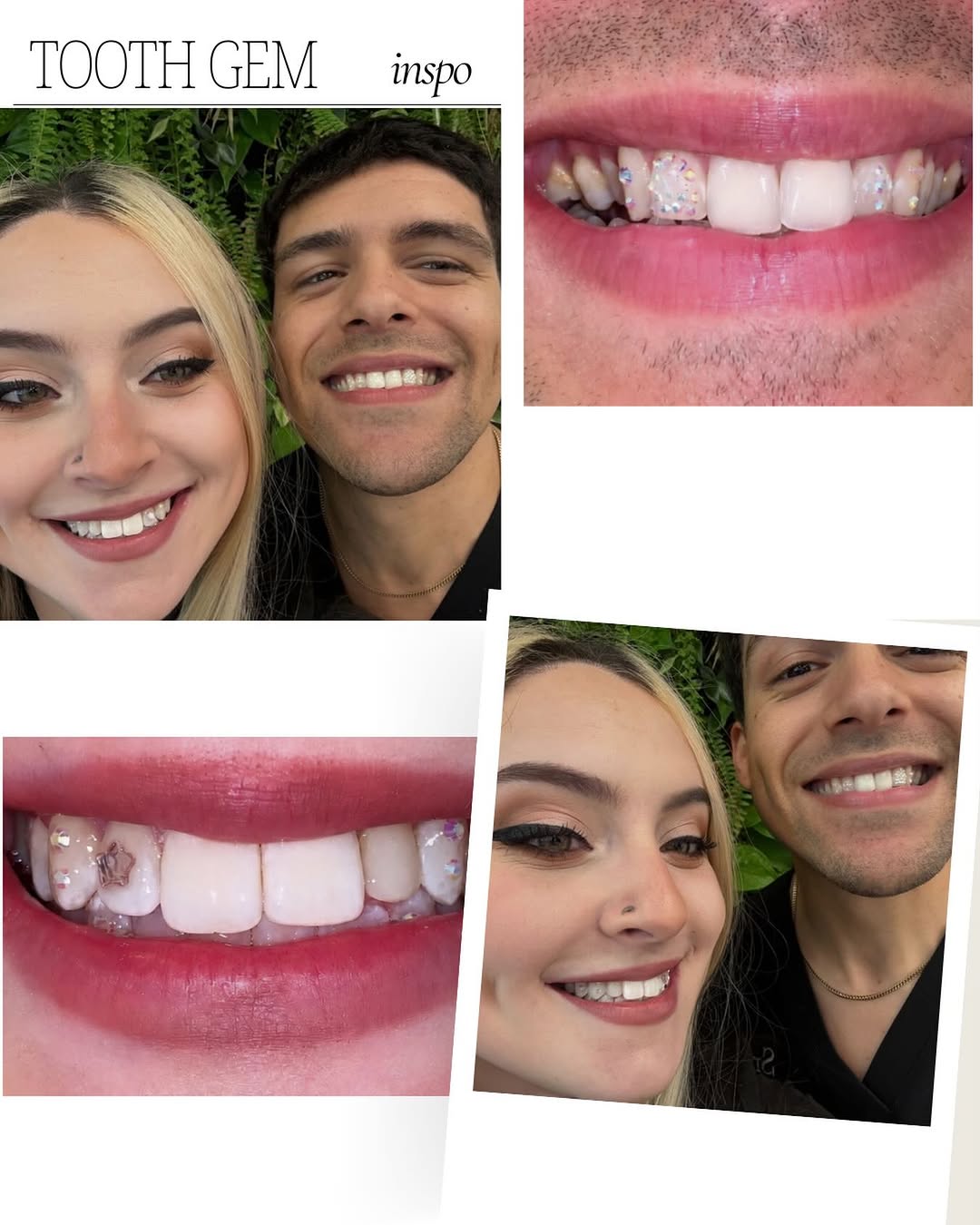 Instagram post by Dr. Amy James, D: Who needs tooth gems? YOU NEED TOOTH GEMS! 🦷 💖✨ Say less. Book now 😁✨ 💎