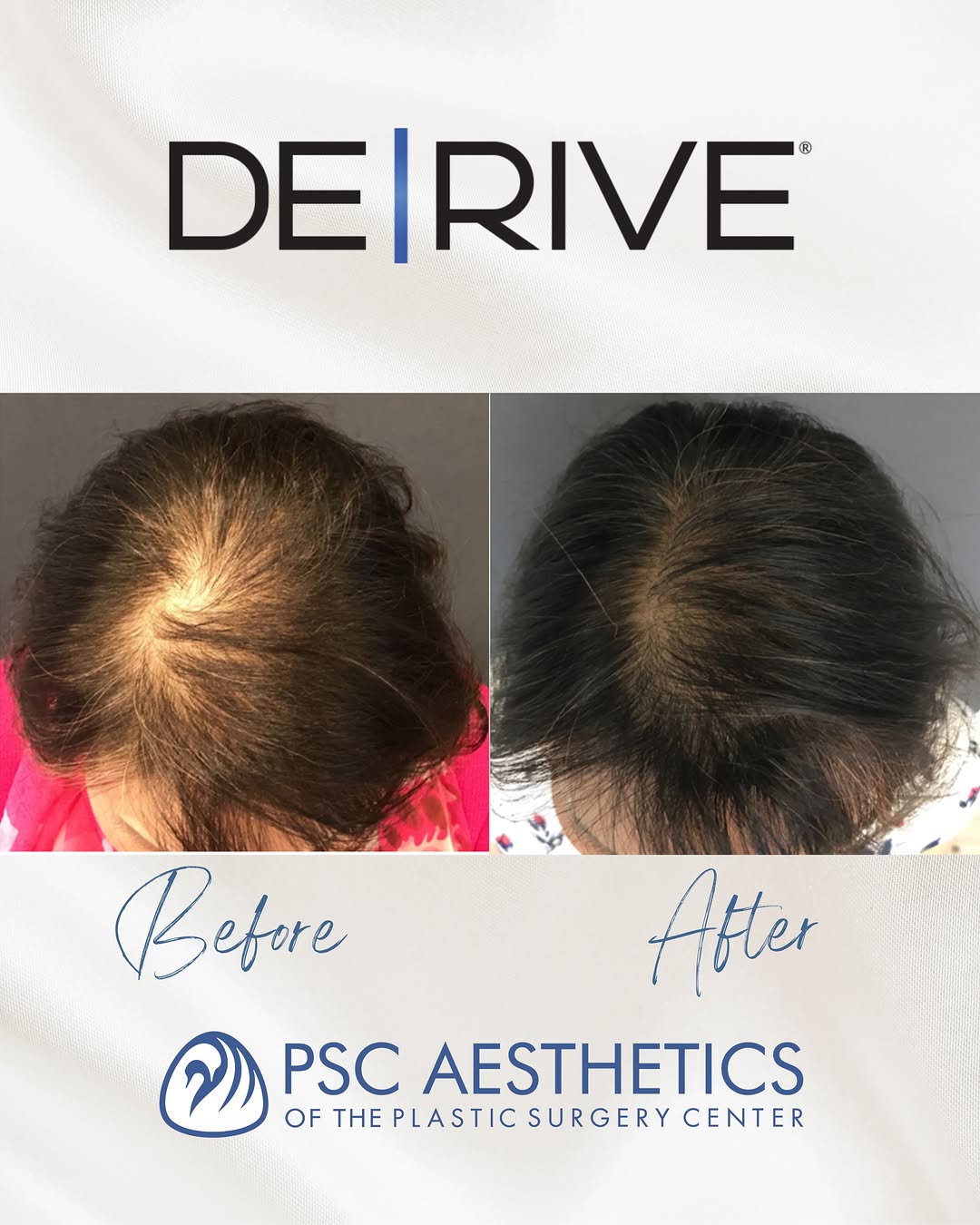 Instagram post by Dr. Amy M. Sprole: Hair support starts at the scalp. ✨ So, what exactly is DE|RIVE? We’re answering your most common questions about this innovative, plant-bas…