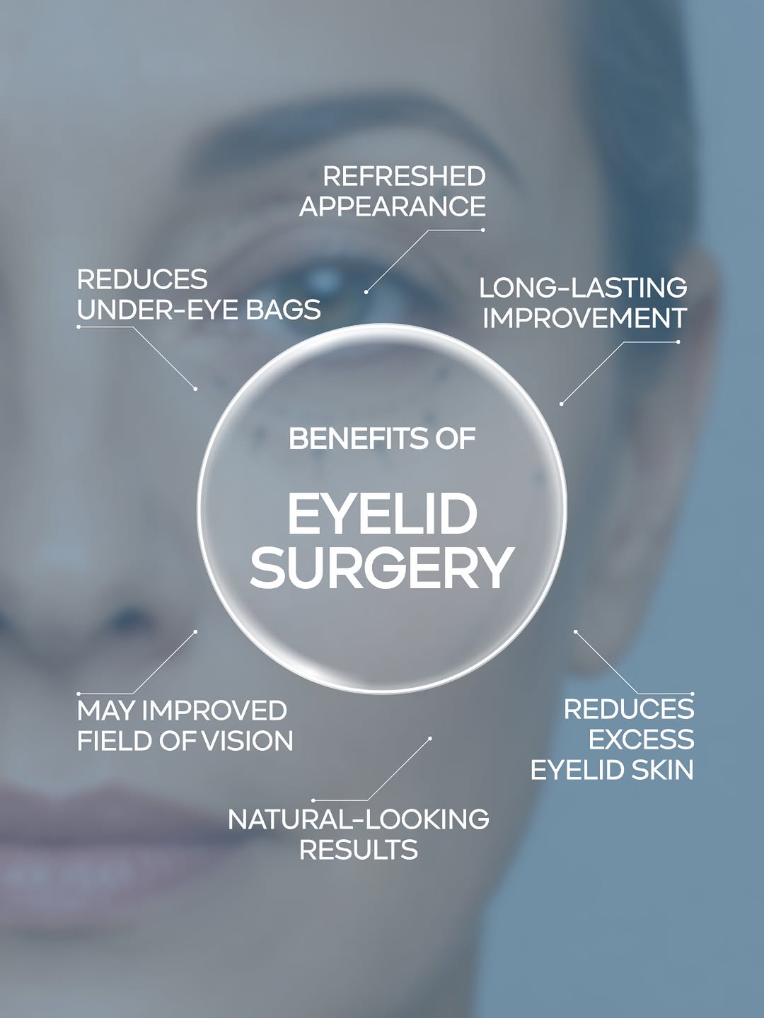 Instagram post by Dr. Andre Aboolian: Eyelid surgery is about more than looking younger - it’s about creating a refreshed, natural appearance while preserving what makes you look…