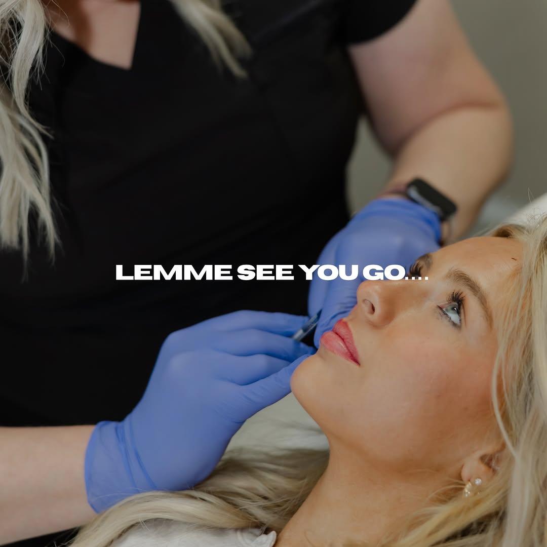 Instagram post by Dr. Andrea Volk: Let me see you go BOW BOW BOW 💋✨ When the lip filler results speak for themselves 😮‍💨 Swipe through some of our favorite before & afters!…