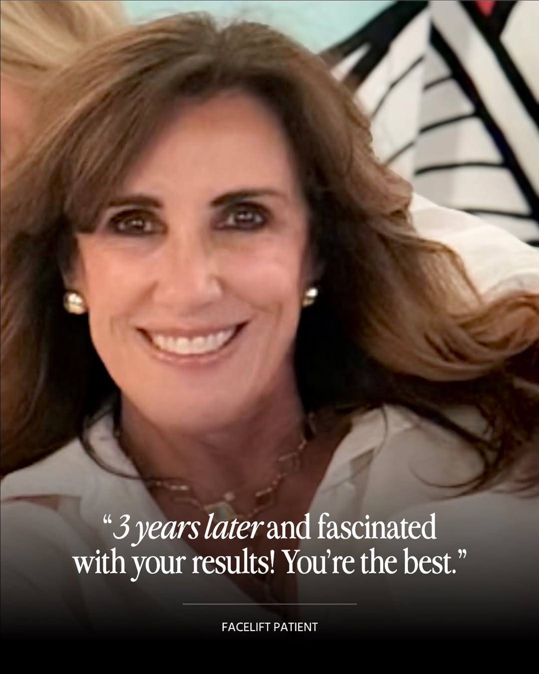 Instagram post by Dr. Andres Bustillo: There is no greater compliment than a patient who still loves their results years after surgery.😊 Great facelift results aren’t just about …