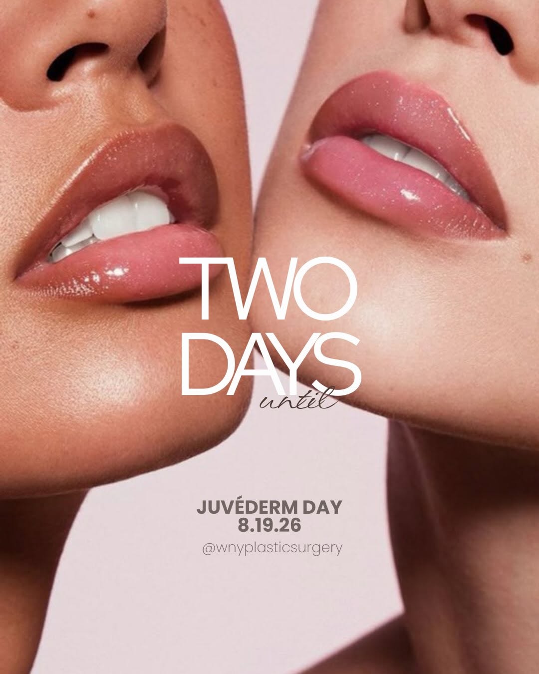 Instagram post by Dr. Andrew P. Giacobbe: Only 2 more days! ⟡ JUVÉDERM® DAY - 8.19.26 ⟡ → get one $75 JUVÉDERM® gift card, get one free (only on 8/19) → book a consultation and get t…