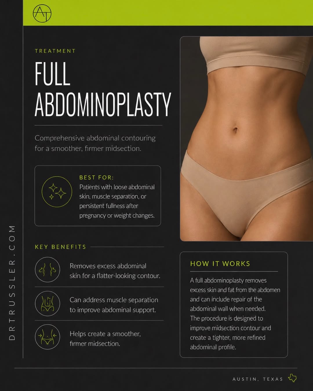 Instagram post by Dr. Andrew P. Trussler: A tummy tuck is about more than removing excess skin. A full abdominoplasty can address multiple changes to the midsection at once, includin…