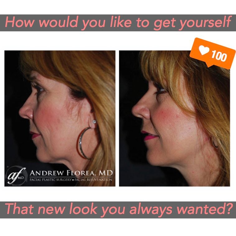 Instagram post by Dr. Andrew S. Florea: 🌺🌻Spring is here🌼🌷Tag 🎯that special Woman or Man in your life who has been talking about it. Give a gift 🎁 of lasting, immediate resul…