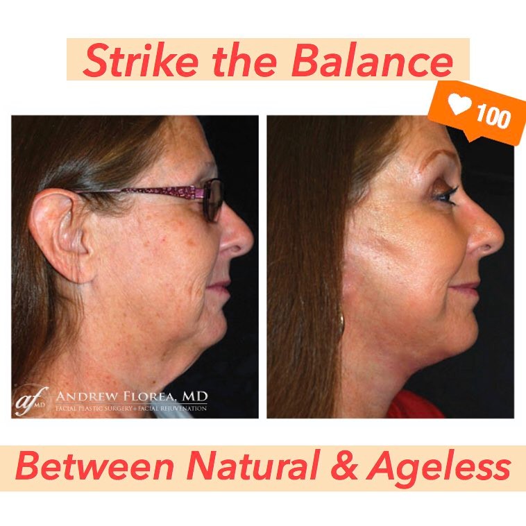 Instagram post by Dr. Andrew S. Florea: 💆Look your best! The results are clear🔮 What are you waiting⌛️for? 🔅Visit us today🌴 🏥We would love to meet you ✅Free consultation ☎️909…