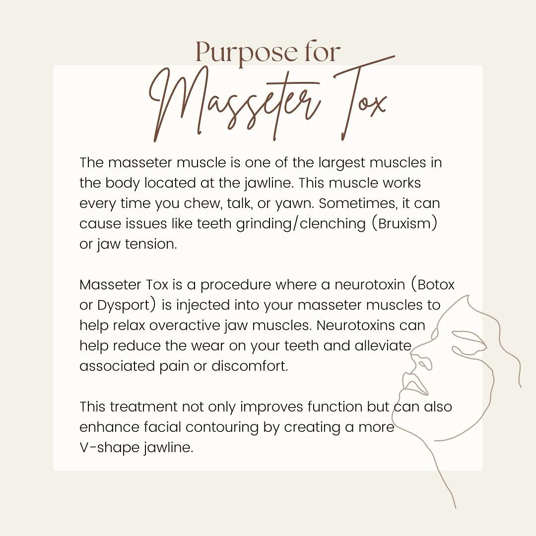 Instagram post by Dr. Andrew T. Lyos: Masseter Tox is a procedure where a neurotoxin (Botox or Dysport) is injected into your masseter muscles to help relax overactive jaw muscle…