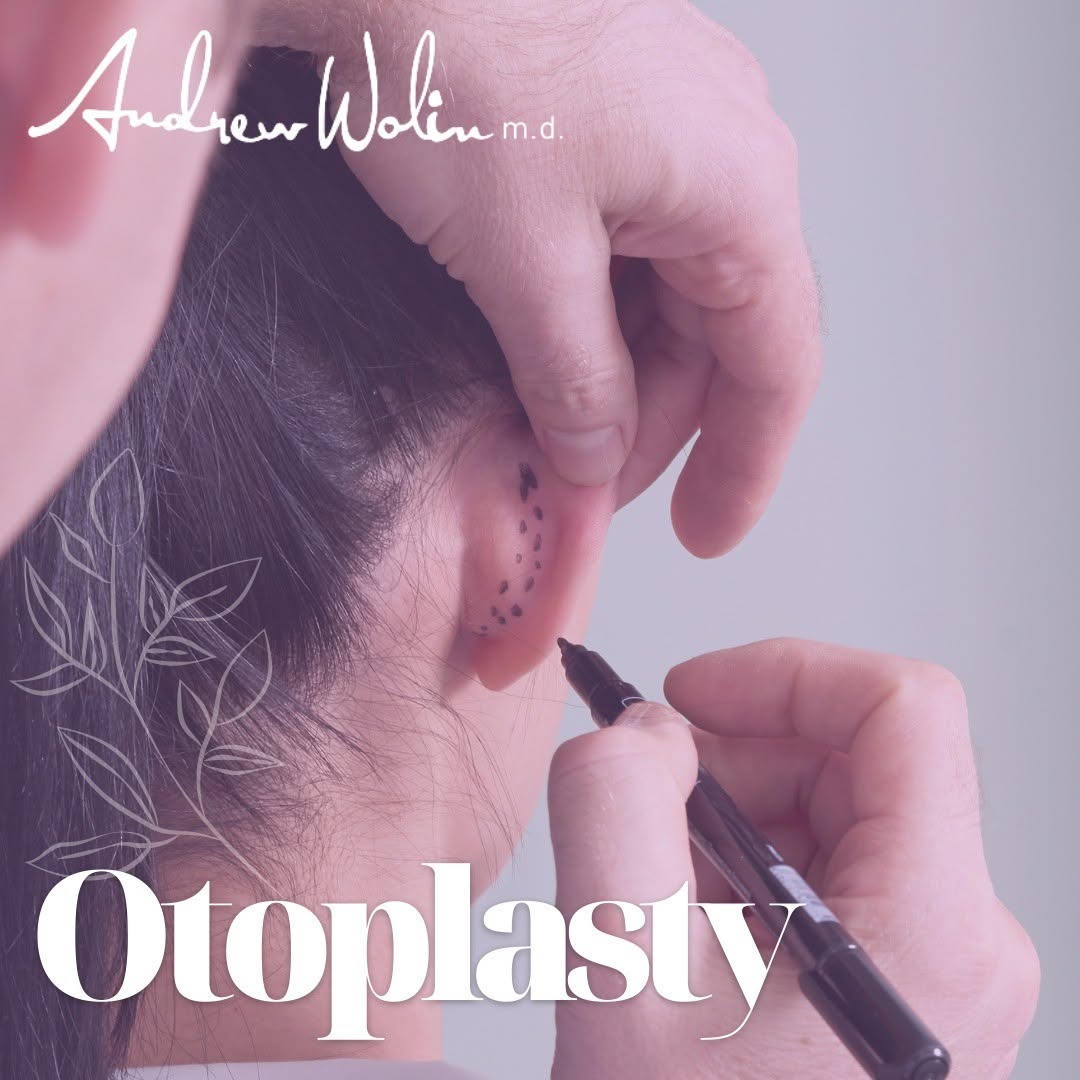 Instagram post by Dr. Andrew Wolin: Otoplasty is a surgical procedure to improve the appearance of protruding ears. This condition is treatable and can help people who seek out…