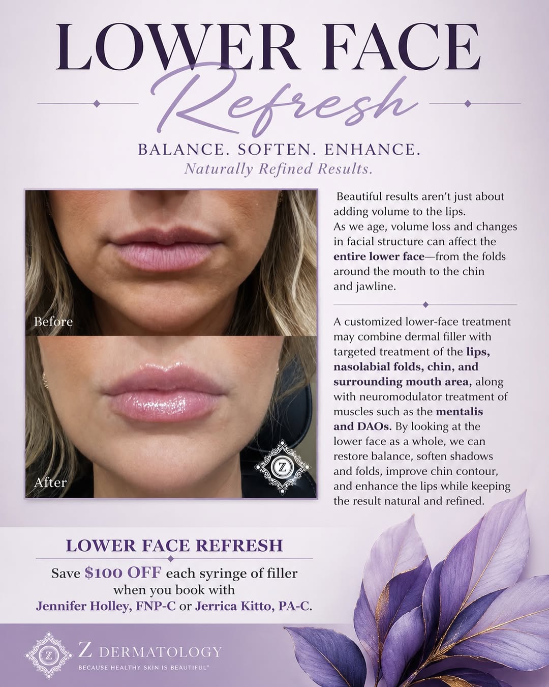 Instagram post by Dr. Ann Zedlitz: It’s not just about the lips—it’s about creating balance. 💜 A customized lower-face refresh can soften folds, enhance the lips, define the …