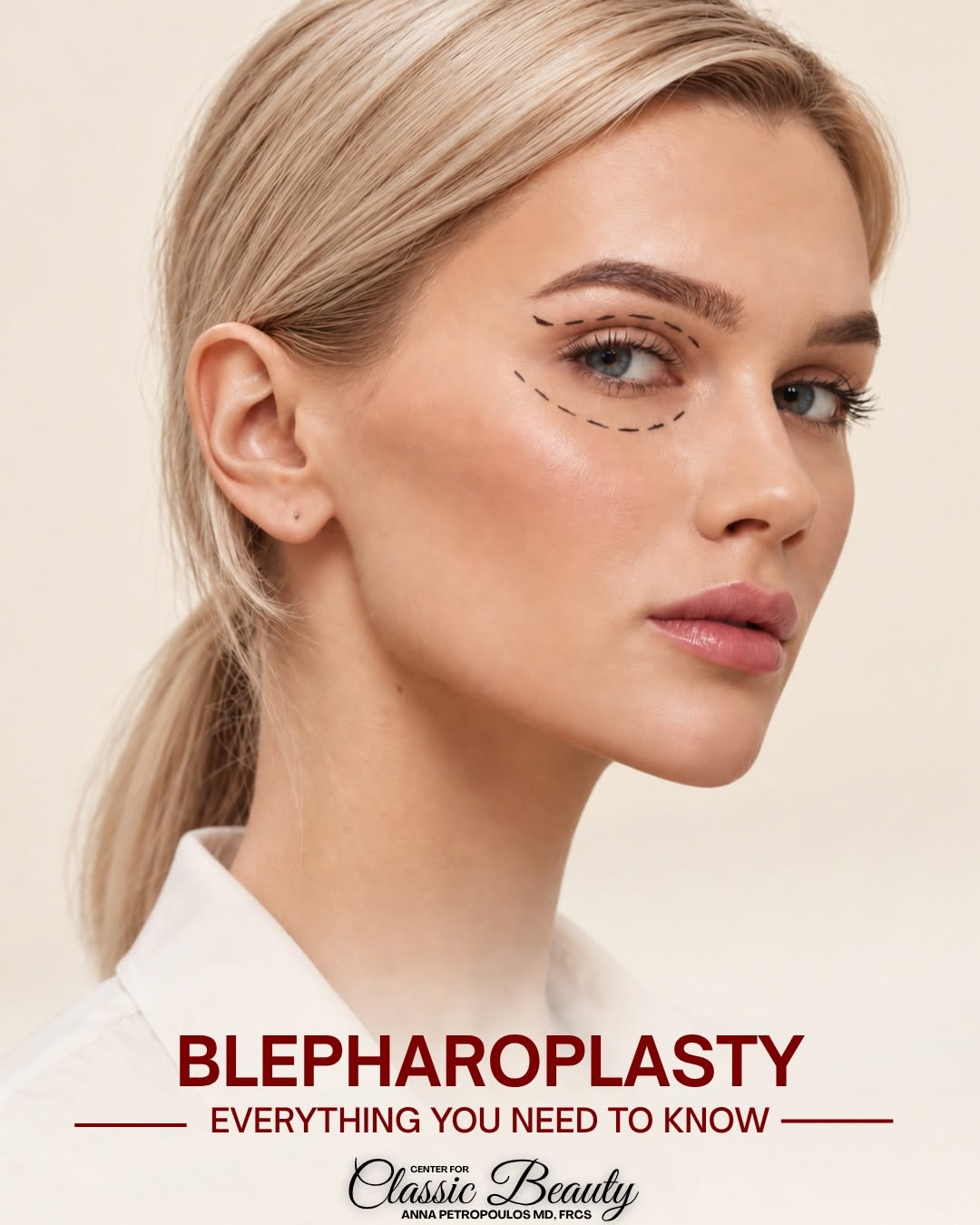 Instagram post by Dr. Anna Petropoulos: Blepharoplasty - Everything You Need to Know Blepharoplasty removes excess skin and, when appropriate, fat from the upper or lower eyelids t…