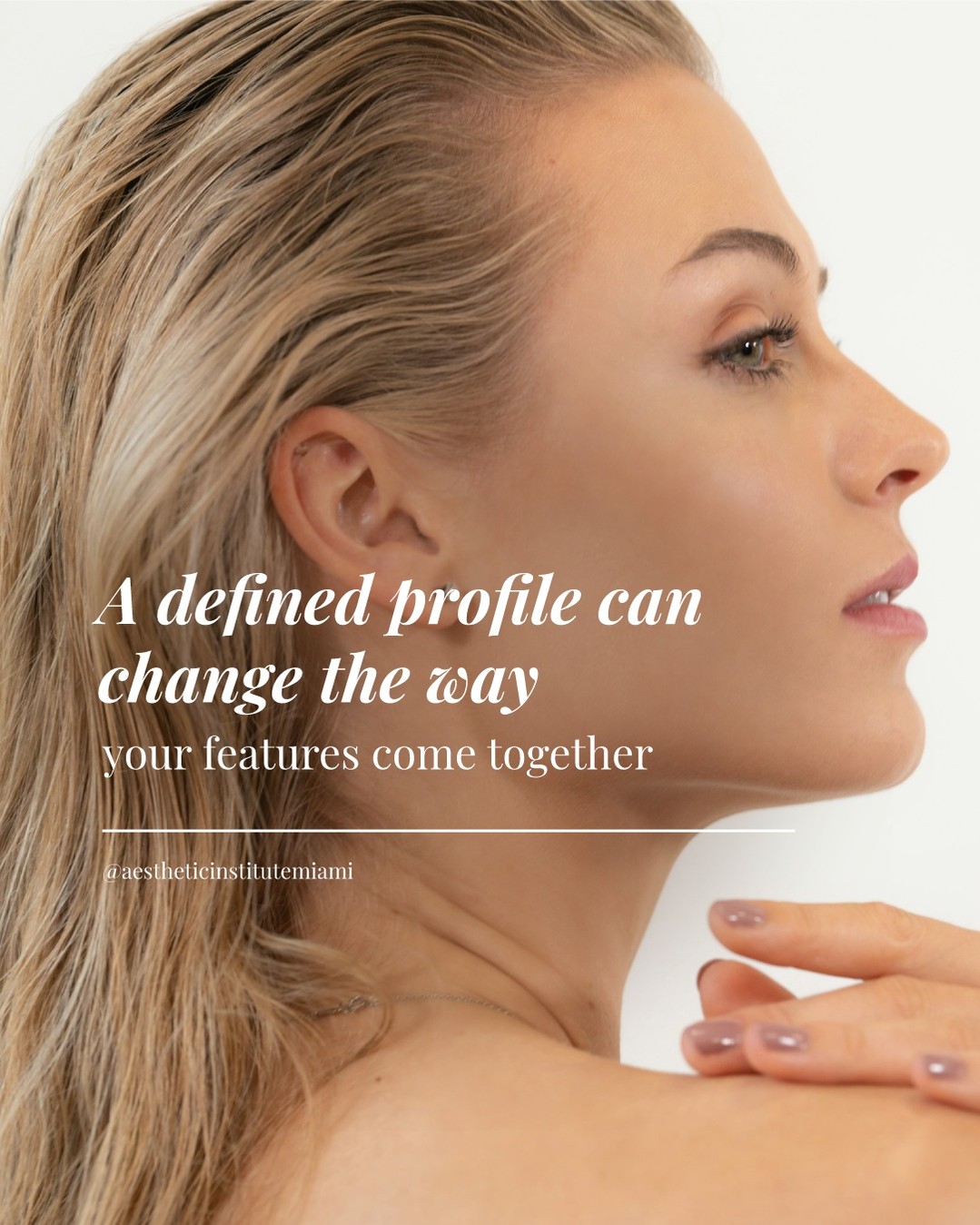 Instagram post by Dr. Anna Sottile: Submental fullness can soften the appearance of the jawline and affect facial balance. Kybella is designed to target fat cells beneath the c…