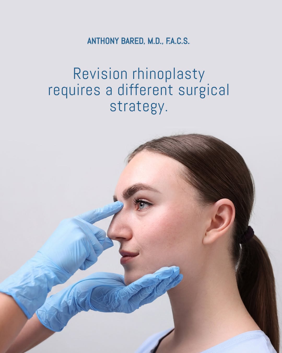 Instagram post by Dr. Anthony Bared: Revision rhinoplasty is not simply a second version of primary rhinoplasty. Previous surgery can alter the nasal anatomy through scar tissue…