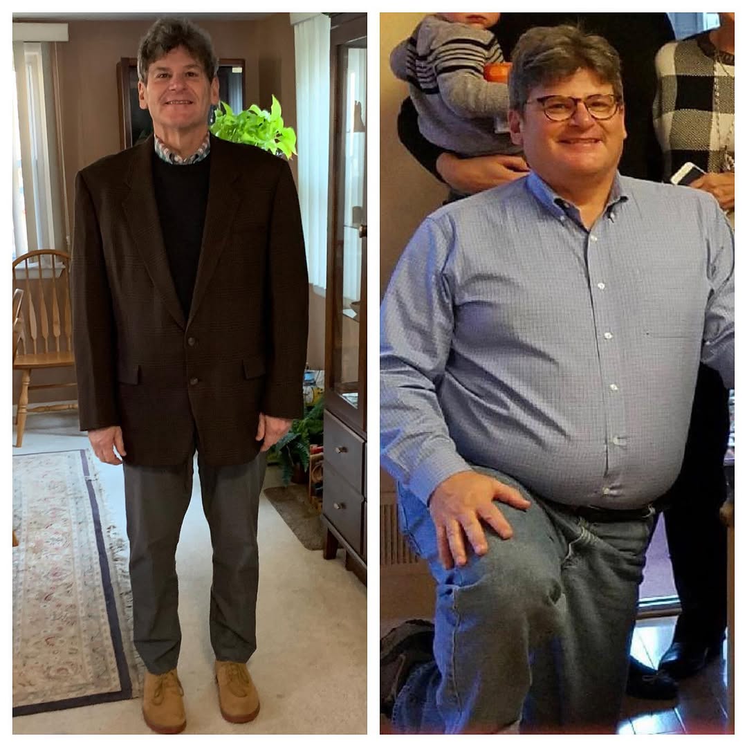 Instagram post by Dr. Anthony Maffei: 🚨🚨🚨Success story alert 💪👀 From 276 pounds down to 191 pounds! Down a total of 85 pounds! Before weight loss surgery, Clifford described…