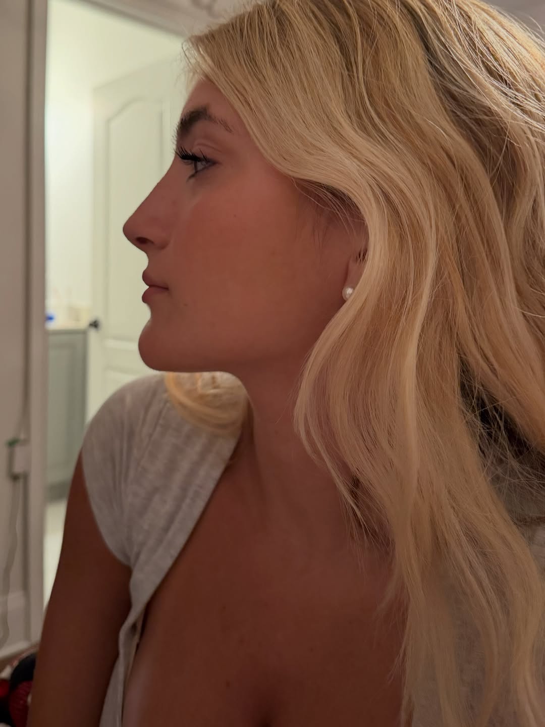 Instagram post by Dr. Anthony Sparano: It made my day receiving this pic and hearing my patient is “so happy” after her rhinoplasty. She’s a beautiful young lady, inside and out, …