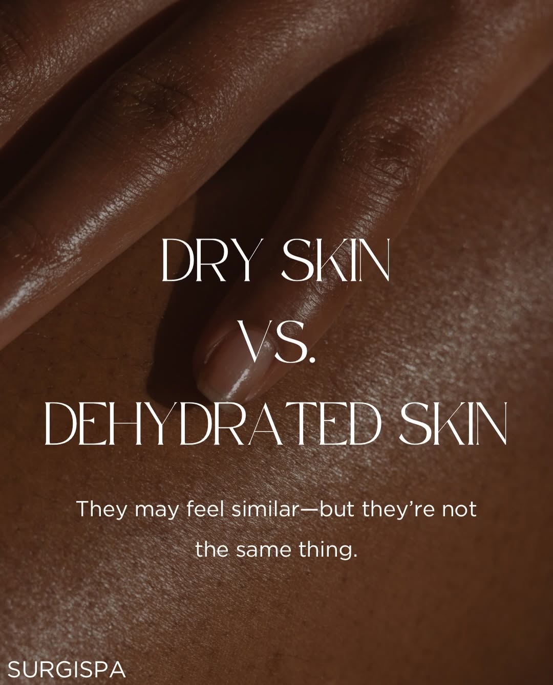 Instagram post by Dr. Arthur M. Cambeiro: Dry skin and dehydrated skin aren’t the same thing—and yes, you can have both. 💧✨ Dry skin naturally produces less oil, while dehydrated sk…