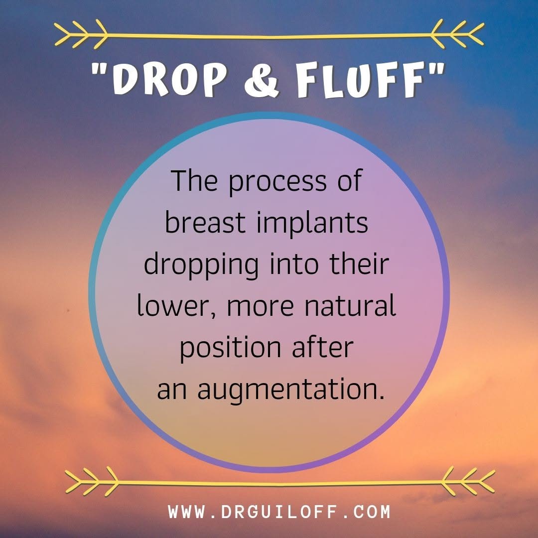Instagram post by Dr. Arturo Guiloff: When do implants really "drop and fluff"? https://www.drguiloff.com/cosmetic-confidence-corner/when-do-implants-really-drop-and-fluff #breas…