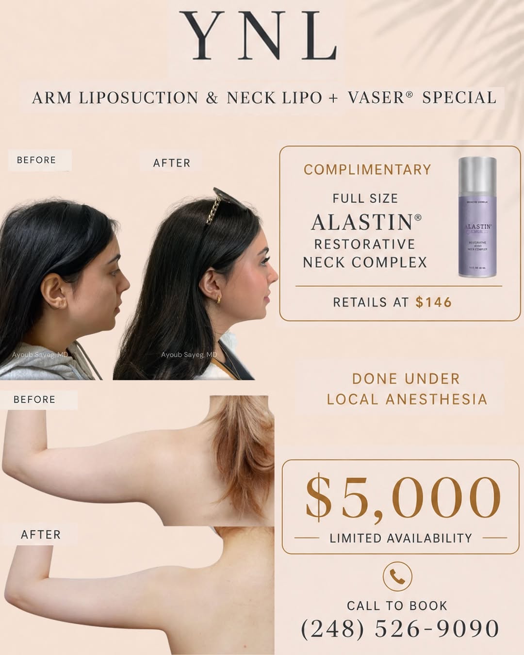 Instagram post by Dr. Ayoub Sayeg: ✨ Your Summer Confidence Starts Here. ✨ For a limited time, transform two of the most common trouble areas with our exclusive YNL Summer Pac…