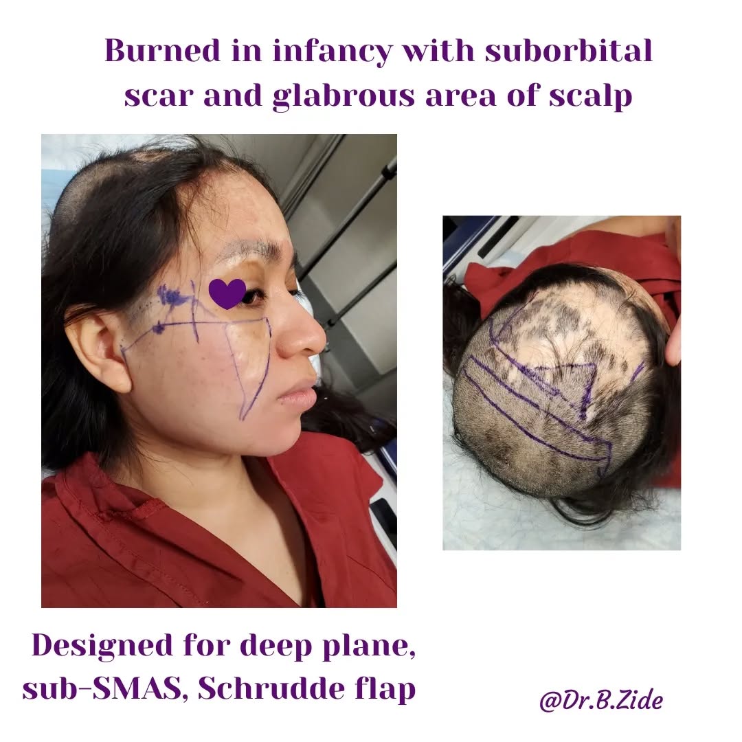 Instagram post by Dr. Barry M. Zide