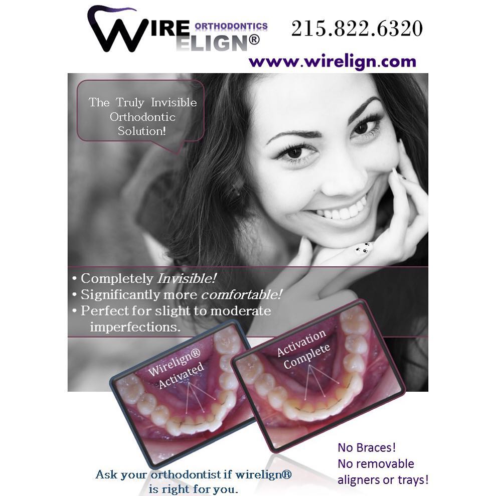 Instagram post by Dr. Benjamin Cassalia, D: #beautifulsmiles #wirelign #incognitobraces #beautifulsmiles #beautifulsmile #braces #lingualbraces #lingualwirelign #lingualorthodontics #d…