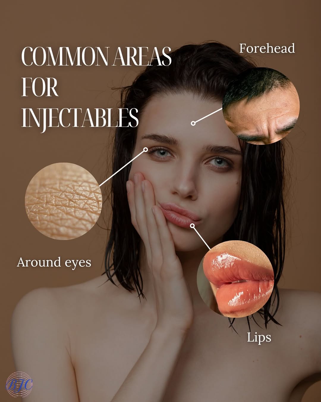 Instagram post by Dr. Benjamin J. Cousins: Thinking about injectables but not sure where to start? 🤔 Some of the most commonly treated areas include: ✨ Forehead lines ✨ Around the ey…