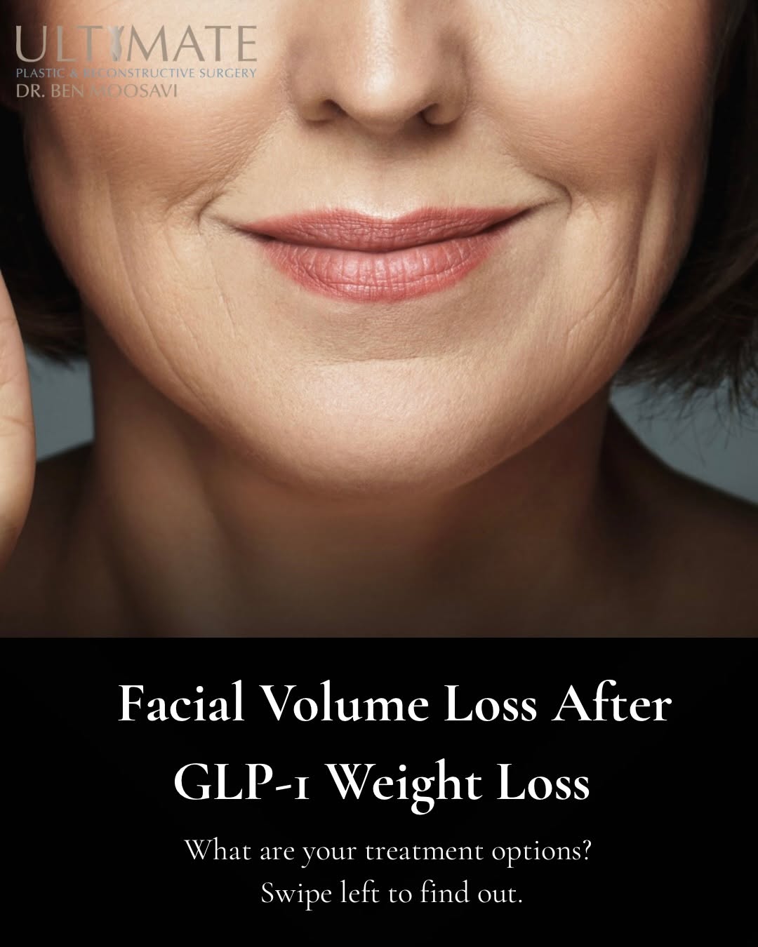 Instagram post by Dr. Benjamin Moosavi: Significant weight loss can change more than the number on the scale. It can also change the face. As facial fat decreases, some patients be…