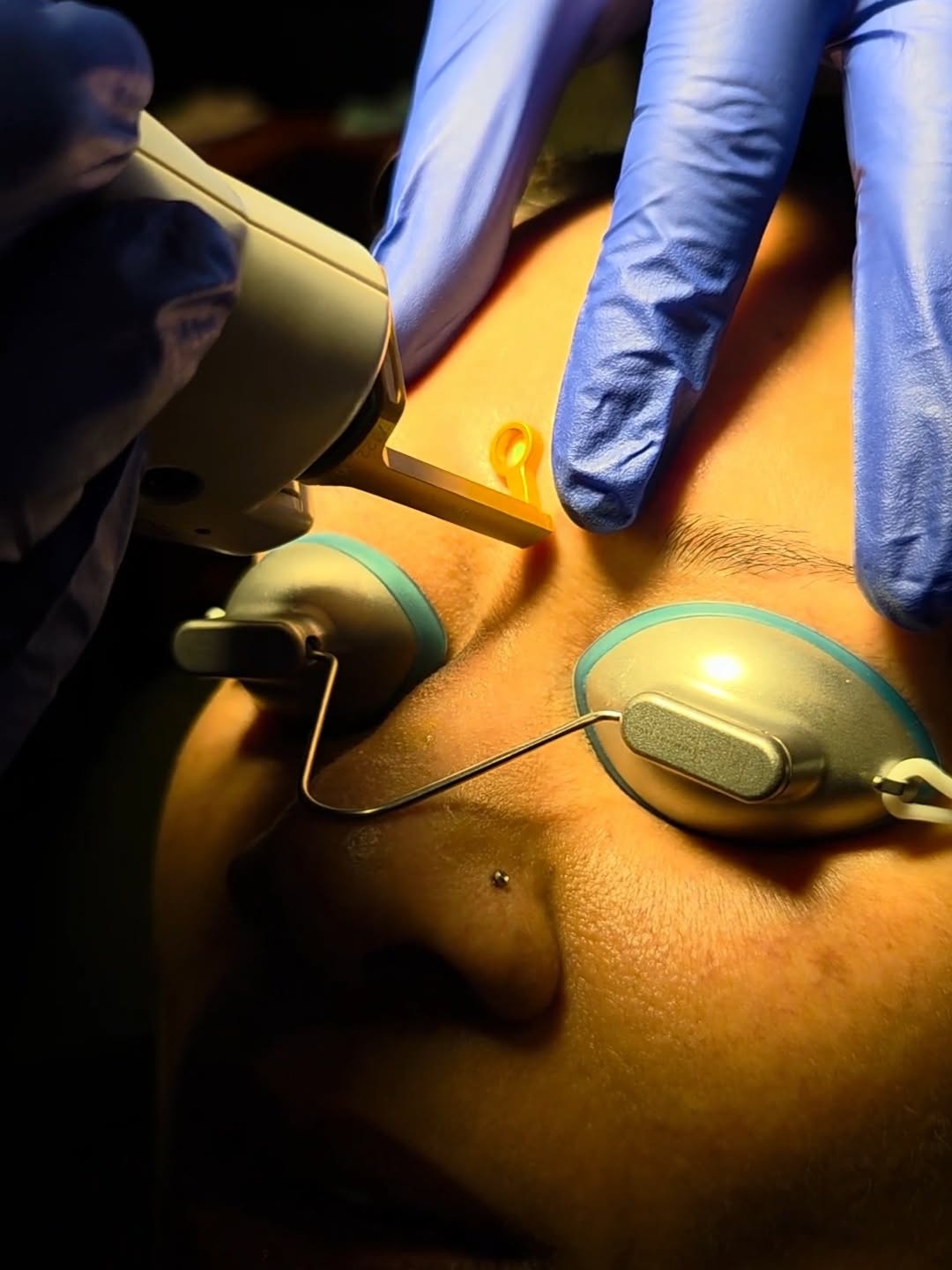 Instagram post by Dr. Benjamin W. Light: Ever curious about getting a laser treatment? Laser treatments can be used to address a variety of skin concerns, but the right treatment an…