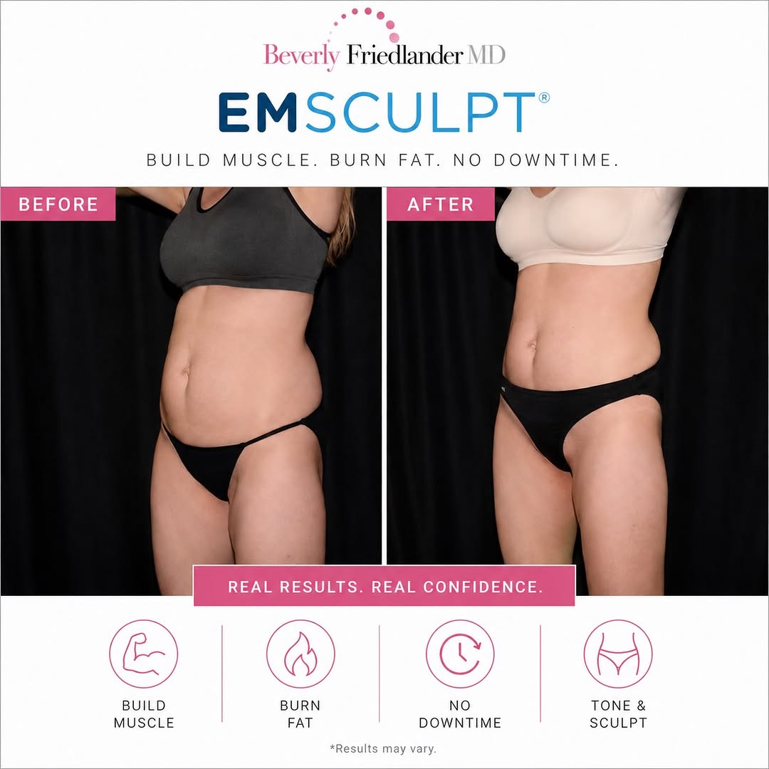 Instagram post by Dr. Beverly Friedlander: ✨Real results. No surgery. No downtime.✨ Join us for our Sculpt & Smooth Event on Thursday, August 13th and discover how Emsculpt can help b…