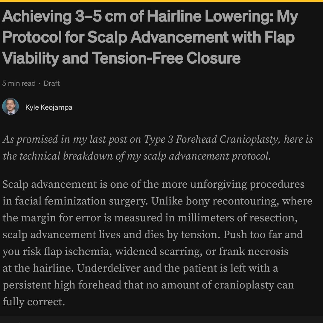 Instagram post by Dr. Bounmany Kyle Keojampa: Want to know how we consistently achieve 3 to 5 cm of hairline lowering—without tension on the incision line? Comment below to be notified …