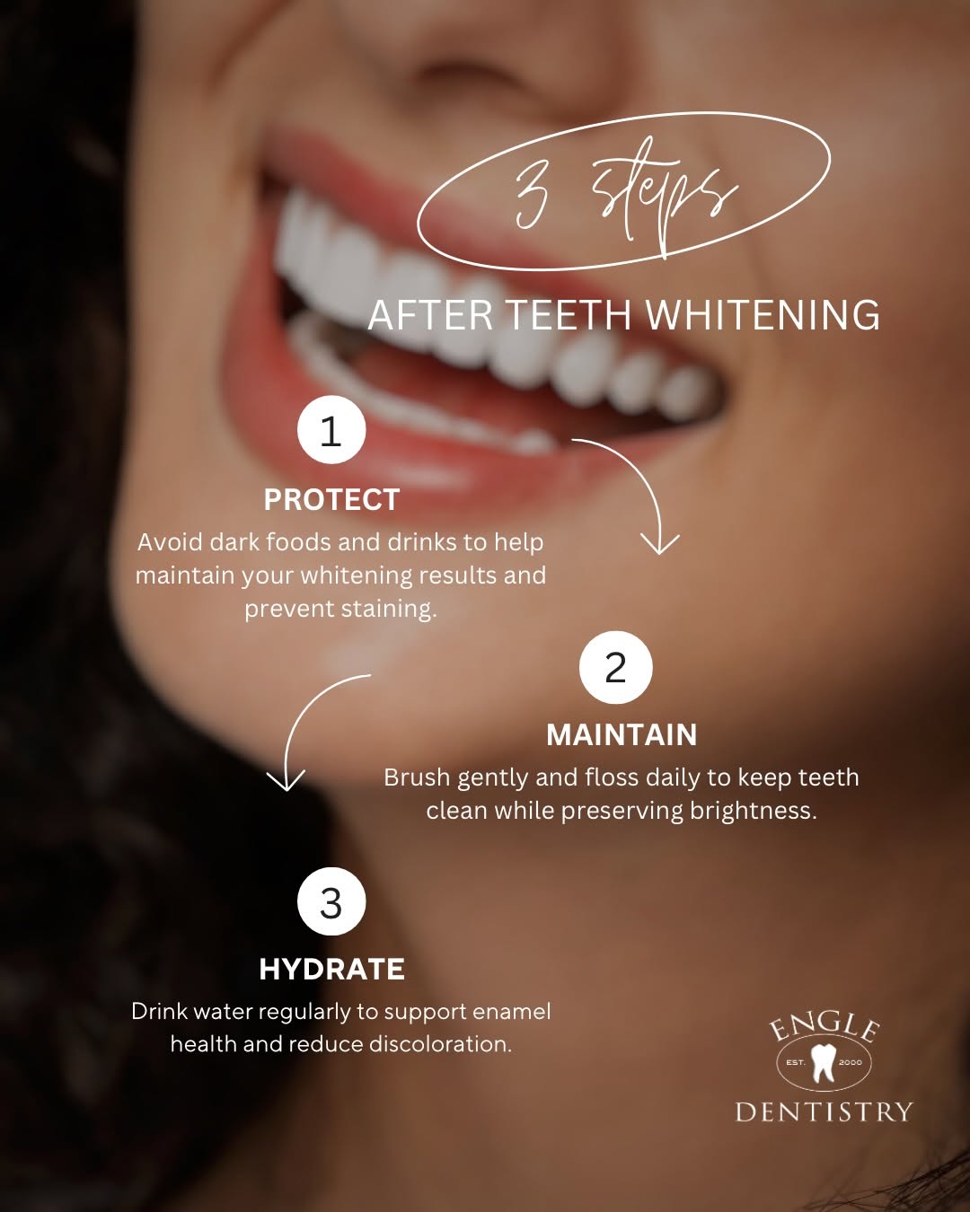 Instagram post by Dr. Bradley J. Engle, D: Brighten your smile in just one visit ✨🦷 Our in-office ZOOM! Whitening treatment is a fast, professional way to lift years of stains and re…
