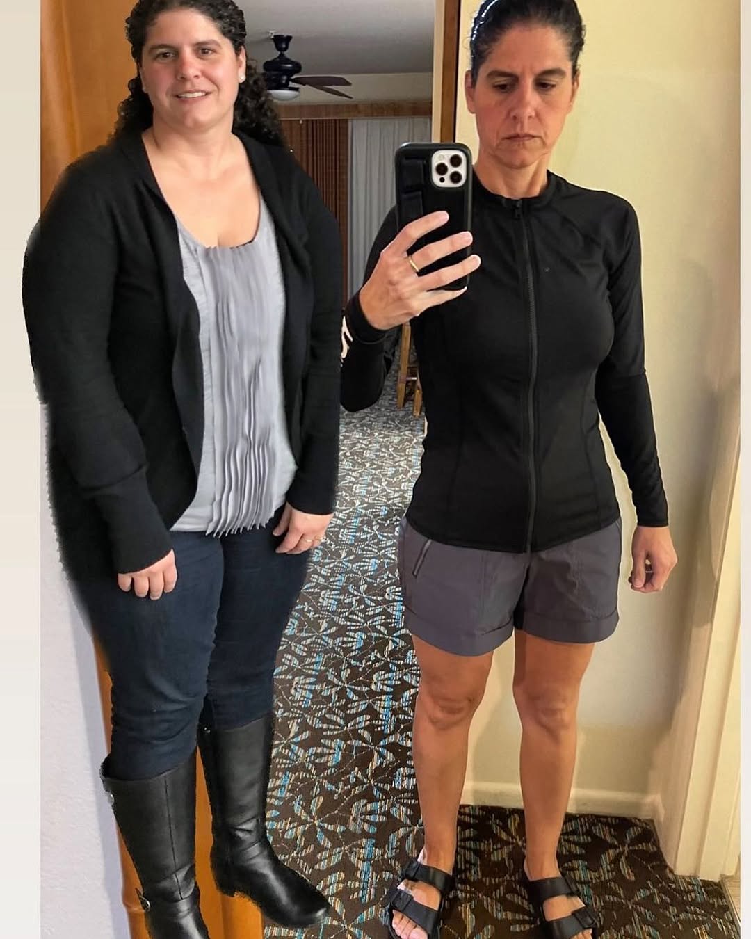Instagram post by Dr. Brian C. Sung: 192–> 122! 70 pounds lost after Endoscopic Sleeve Gastroplasty. Our patient is 16 months out and living her best life. The Endoscopic Sleeve…