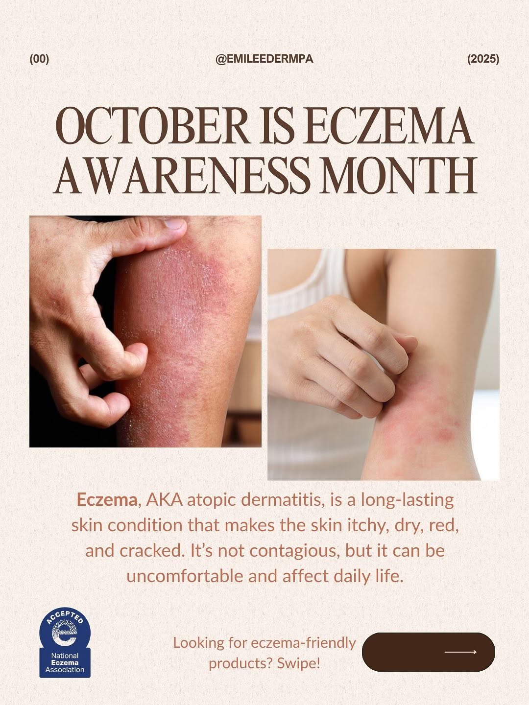 Instagram post by Dr. Brittany Carter-Snell: Your skin deserves the best—especially if you’re living with eczema. I always recommend eczema-safe, fragrance-free products to help soothe,…