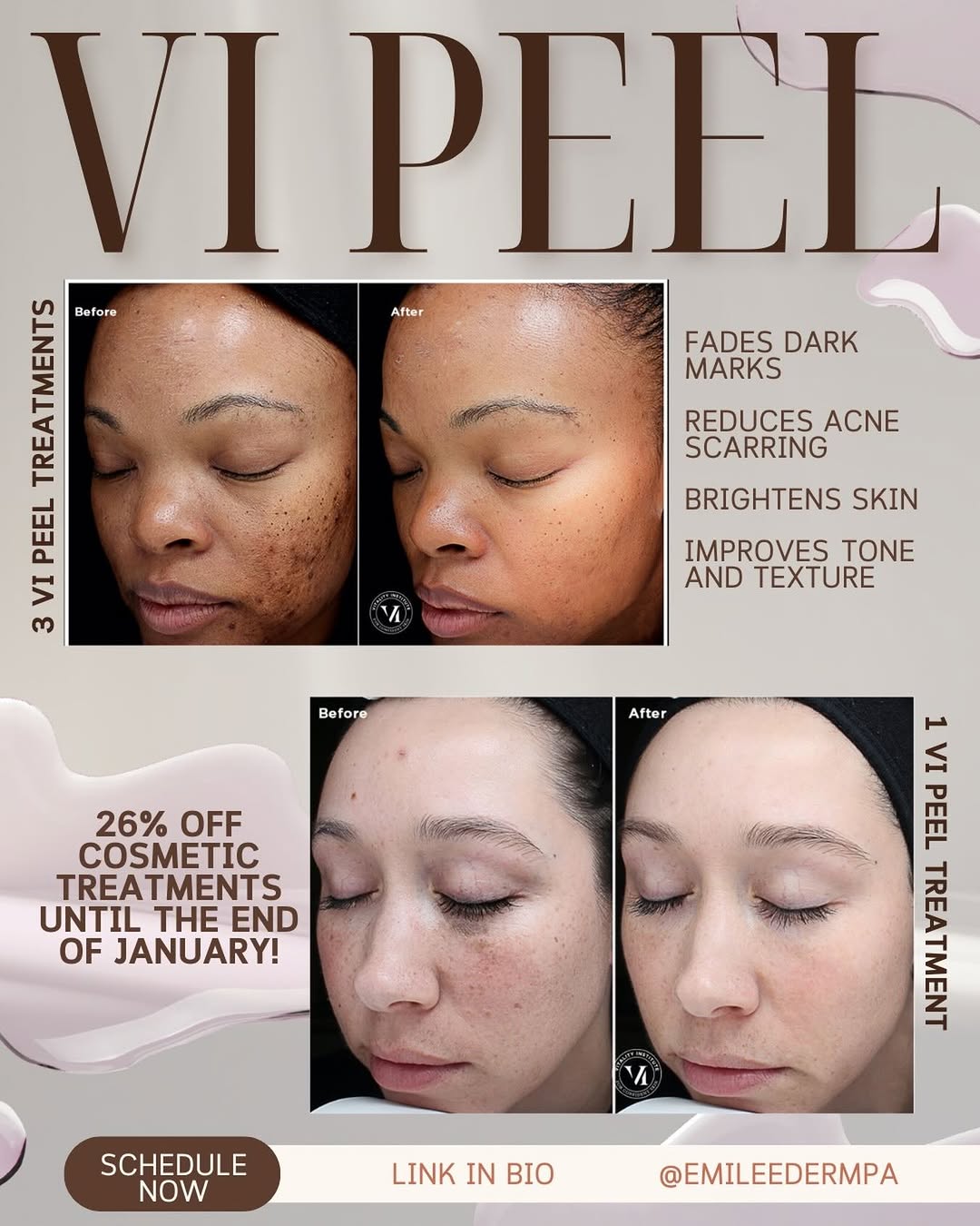 Instagram post by Dr. Brittany Carter-Snell: ✨ VI Peel magic ✨ Targets acne, hyperpigmentation, fine lines, and uneven texture by boosting cell turnover and collagen. Peeling today = gl…
