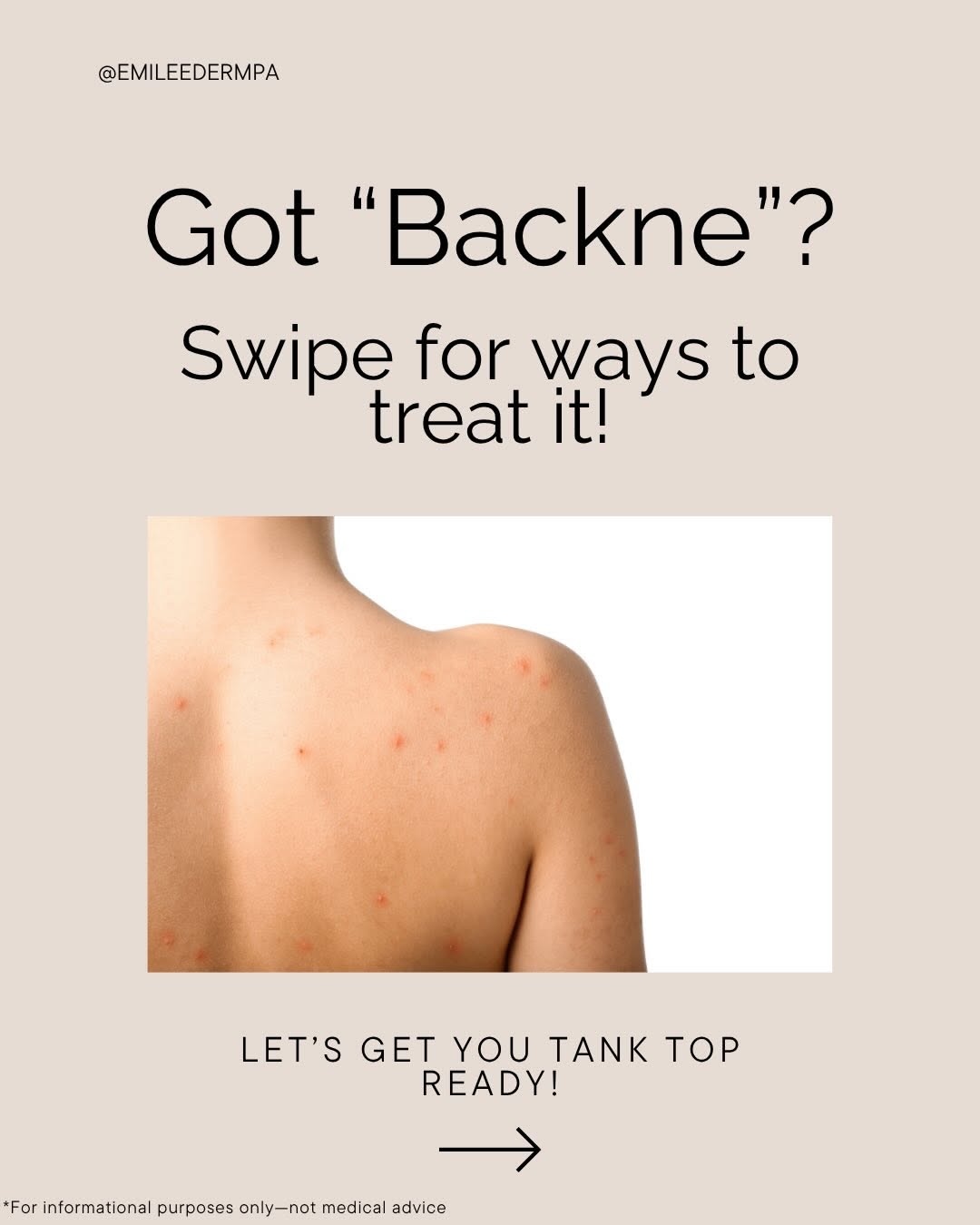 Instagram post by Dr. Brittany Carter-Snell: Bye bye Backne 👋 #BackneTreatment #AcneCare #DermTips #ClearSkinJourney #SkincareRoutine