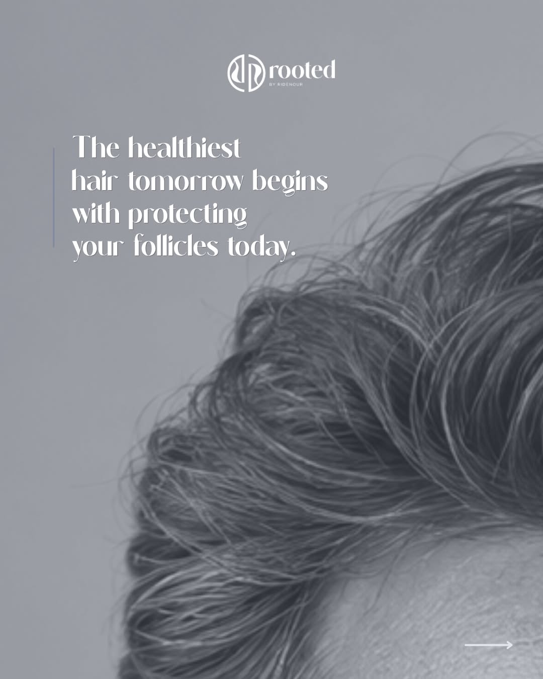 Instagram post by Dr. Brock Ridenour: Whether you’re noticing more hair in the shower, a little less fullness than you used to have, or simply want to protect the hair you have n…